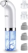 Fineza - Mee eter verwijderaar – Blackhead remover - Mee eters verwijderen – Blackhead – Porienreinigers – 2-in-1 Tool Acne – Meeeters verwijderen – 5 Opzetstukken - Wit