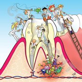 Cartoon plafondplaat - Poster - Roland Hols - Doorsnede kies - 60 x 60 cm - Foamboard 10 mm dik - Tandarts - Orthodontist -Mondhygiënist - voor boven de behandelstoel