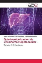 Quimioembolización de Carcinoma Hepatocelular