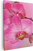 Artaza Canvas Schilderij Roze Orchidee Bloemen - 80x100 - Groot - Foto Op Canvas - Canvas Print