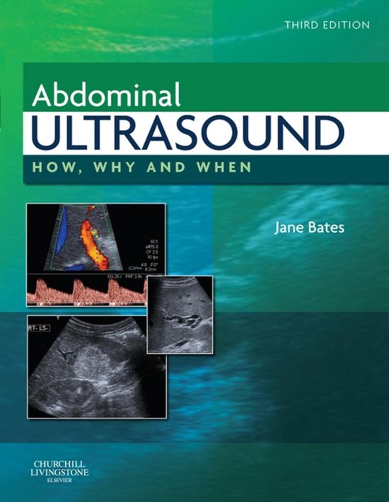 Abdominal Ultrasound E-Book - cover