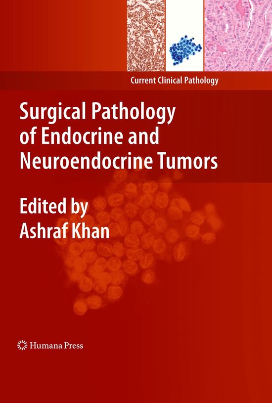 Surgical Pathology of Endocrine and Neuroendocrine Tumors - cover