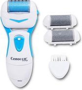 Cenocco Beauty®  Eelt Verwijderaar - Elektrische Voor Pedicure en Voetverzorging - cc9019