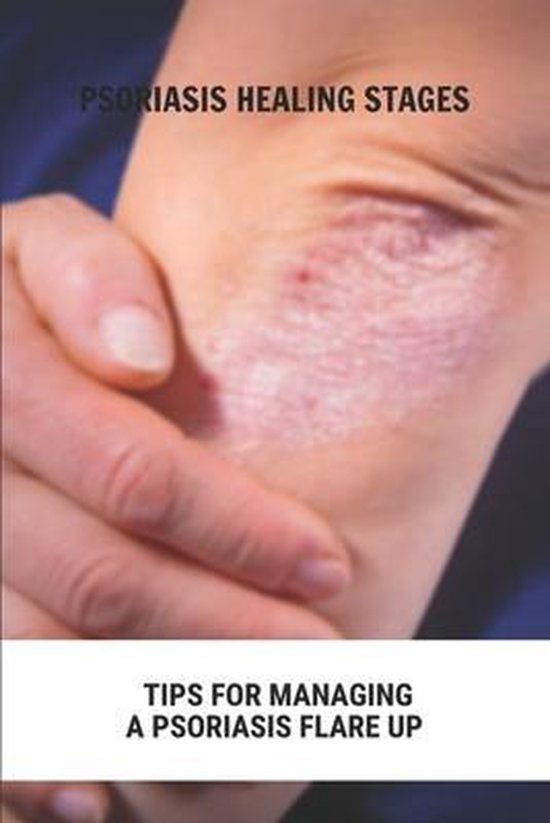 Psoriasis Healing Stages Tips For Managing A Psoriasis Flare Up