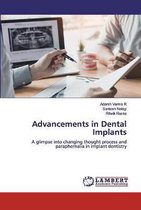 Advancements in Dental Implants