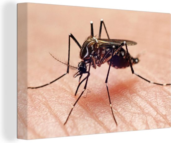 Peintures sur toile - Un moustique pique une main - 150x100 cm - Décoration murale