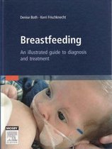 Breastfeeding