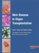 Skin Disease In Organ Transplantation
