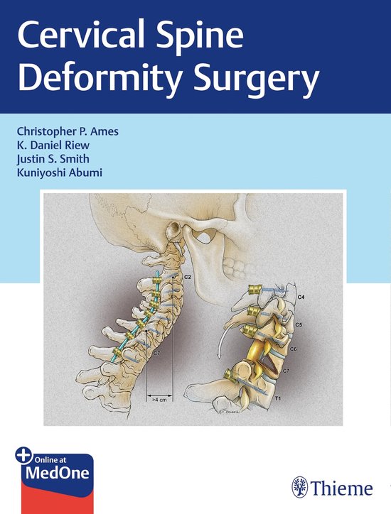 Cervical Spine Deformity Surgery - cover