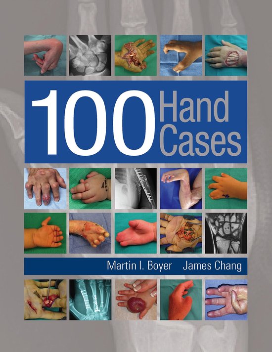 100 Hand Cases - cover