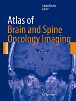Atlas of Brain and Spine Oncology Imaging