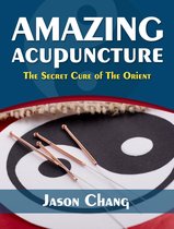 Amazing Acupuncture The Secret Cure of The Orient