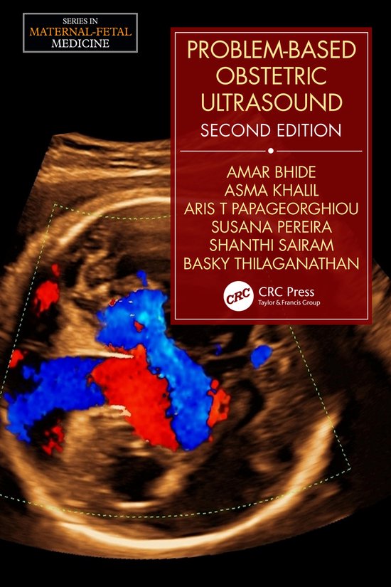 Foto: Series in maternal fetal medicine problem based obstetric ultrasound