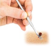 CHPN - Pince à tique - Pince à tiques - Outil anti-tiques - Dissolvant de tiques - Animaux domestiques et personnes - Supprimer la tique - Lyme - Acier inoxydable