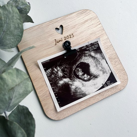 Zwangerschapsaankondiging - Echo - Baby echo - Zwangerschap bekendmaken — afbeelding 3
