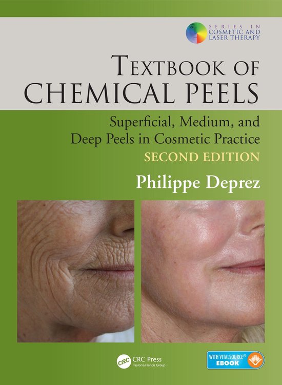 Series in Cosmetic and Laser Therapy - Textbook of Chemical  ... - cover