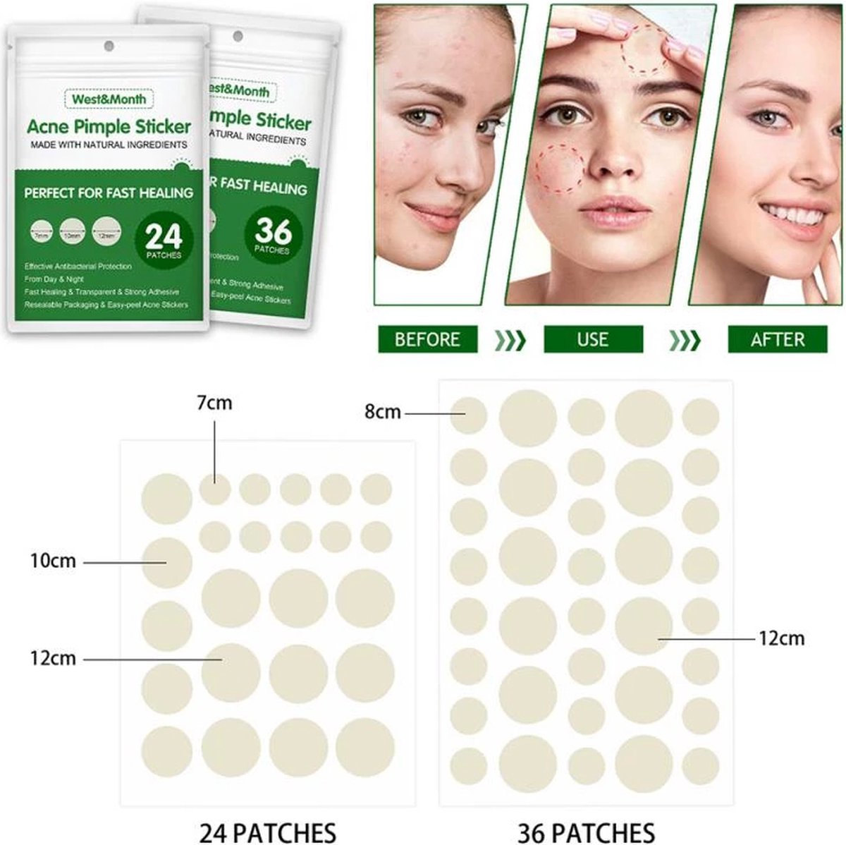 Acne Puistje Patch 36 Pleisters Onzichtbare Stickers Acne Behandeling remover - Puistjes Behandeling Huidverzorging