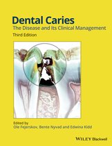 Dental Caries 3rd Edition