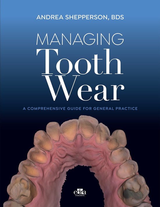 Managing Tooth Wear (ebook), Andrea Shepperson 9781957260594 Boeken