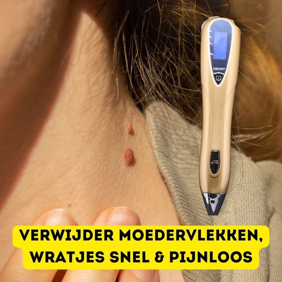 Huid met moedervlekken op de nek, met een gouden plasma pen en tekst in het geel.