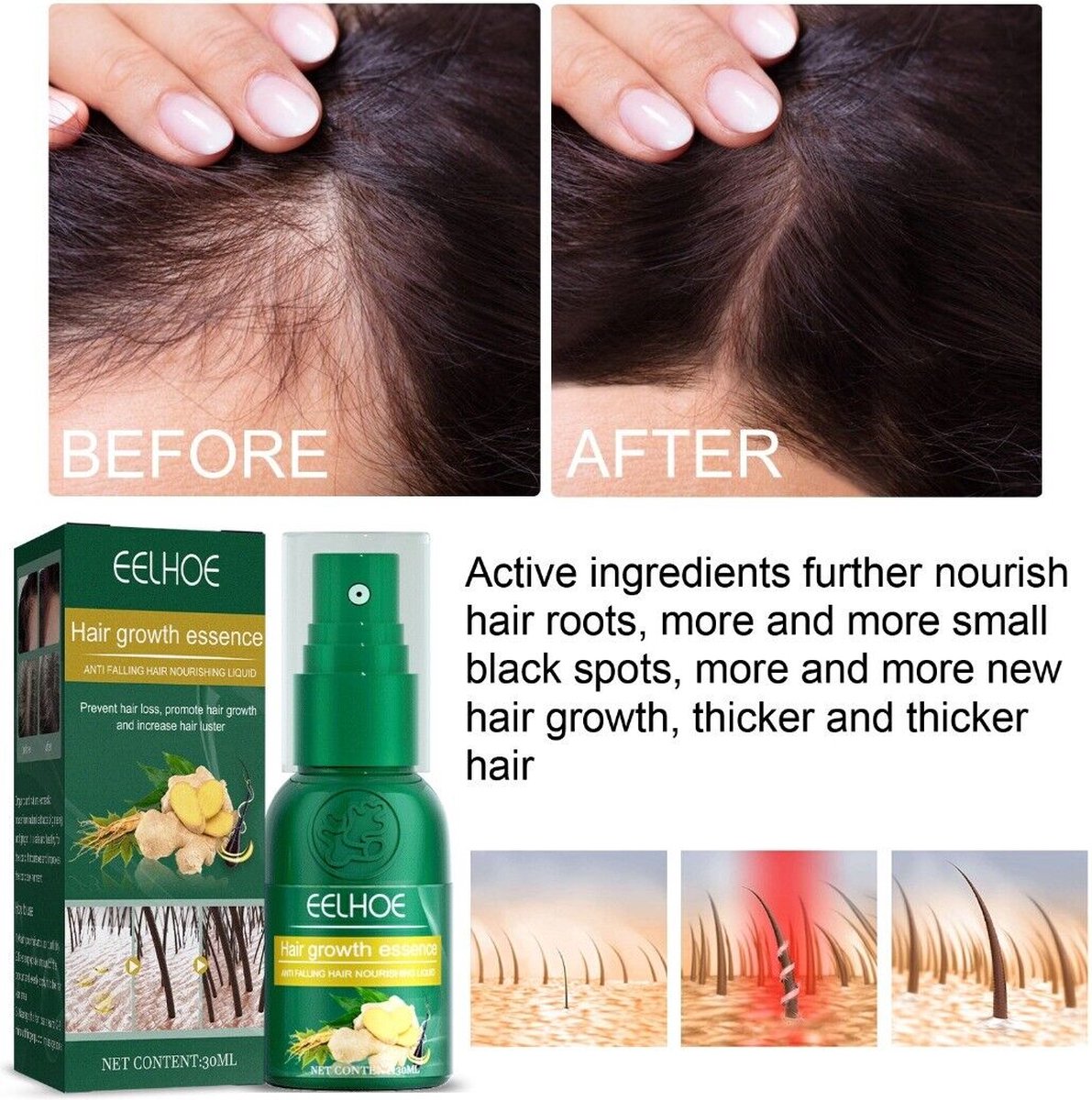 Gember Haargroei Serum - Duo Verpakking - Gember Haar Spray voor Haargoei - Vollere Bos Haren - Anti Kaalheid - Haar Wordt Dikker - Ginger Hairspray - Ga Dunner Wordend Haar Tegen - Betere Baardgroei