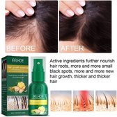 Spray pour Cheveux au gingembre pour la croissance des cheveux - Bouquet de cheveux plus complet - Anti calvitie - Épaissit les Cheveux - Spray pour cheveux au gingembre - Prévient l'amincissement des Cheveux - Meilleure croissance de la barbe