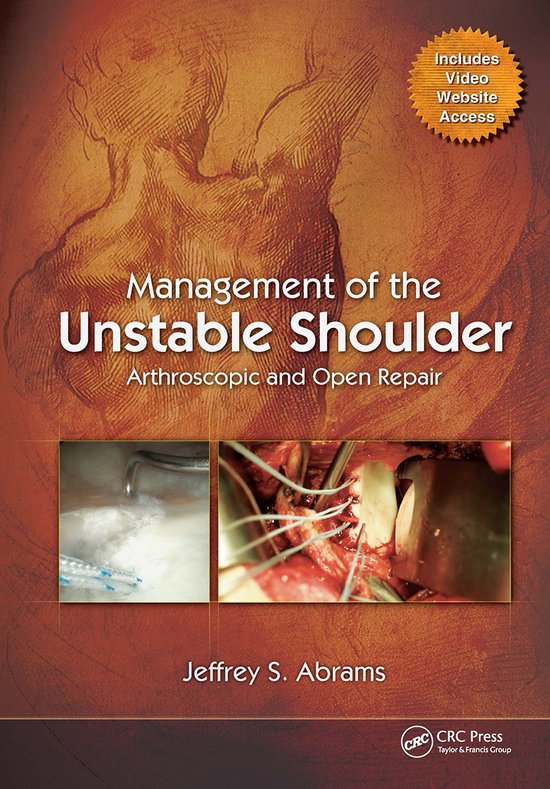 Management of the Unstable Shoulder - cover