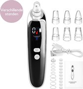 Vivel Blackhead Remover Vacüum - Poriënreiniger - Mee-eter Verwijderaar - Elektrisch & Draadloos