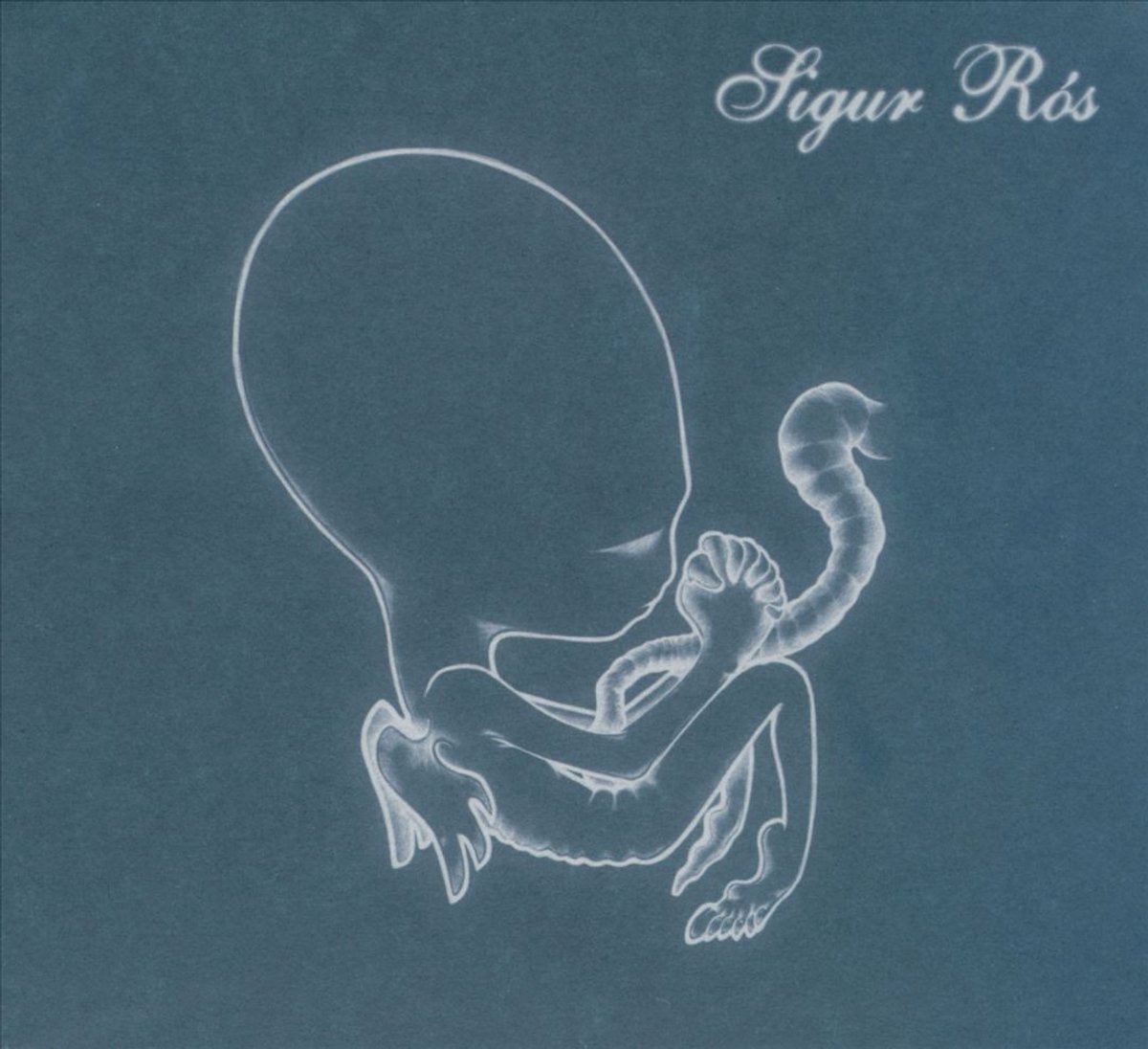 Agaetis Byrjun