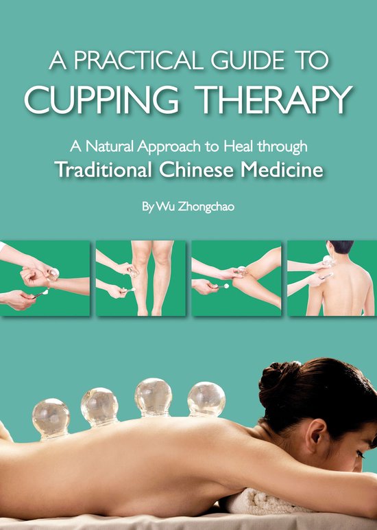 Practical Guide to Cupping Therapy - cover