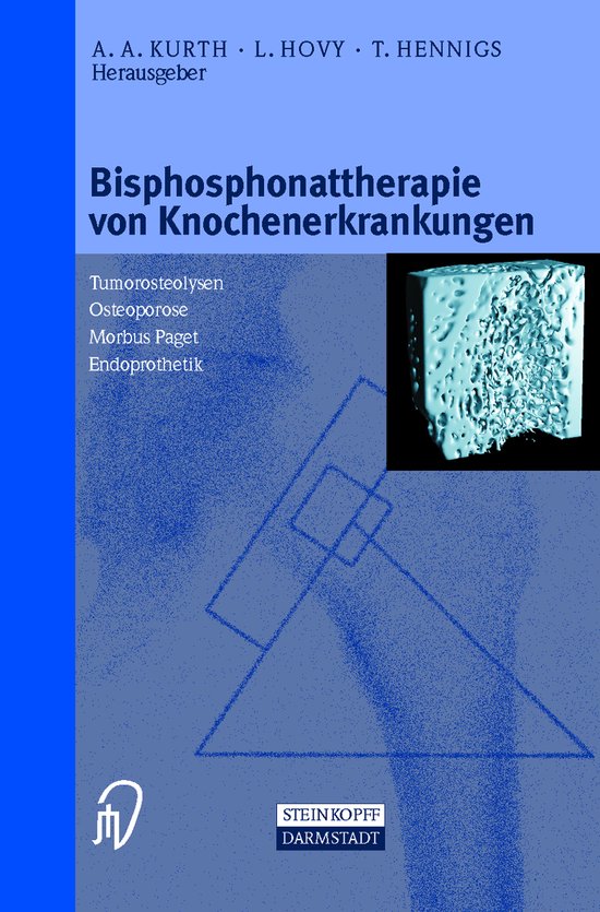 Bisphosphonattherapie Von Knochenerkrankungen - cover