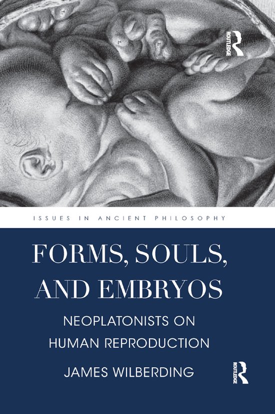 Issues in Ancient Philosophy- Forms, Souls, and Embryos