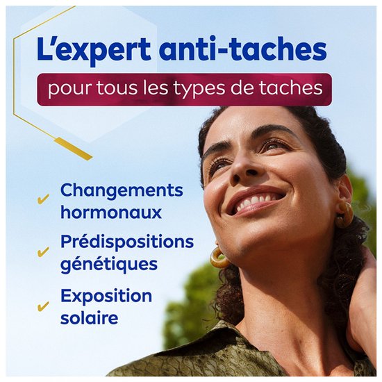 Lachende vrouw met krullen; anti-vlekken expert voor hormonale veranderingen, genen en zonlicht.