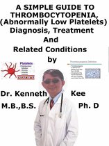 A Simple Guide to Thrombocytopenia (Abnormally Low Platelets), Diagnosis, Treatment and Related Conditions