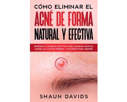 Cómo Eliminar el Acné de Forma Natural y Efectiva: Remedios altamente efectivos para eliminar granos, espinillas, puntos negros y cicatrices para siempre