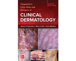 Fitzpatrick's Color Atlas and Synopsis of Clinical Dermatology, Ninth Edition