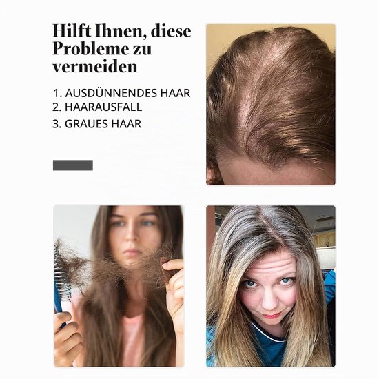 Haar topper voor vrouwen met 3 clips, glad synthetisch haarstuk voor dun haar — afbeelding 3