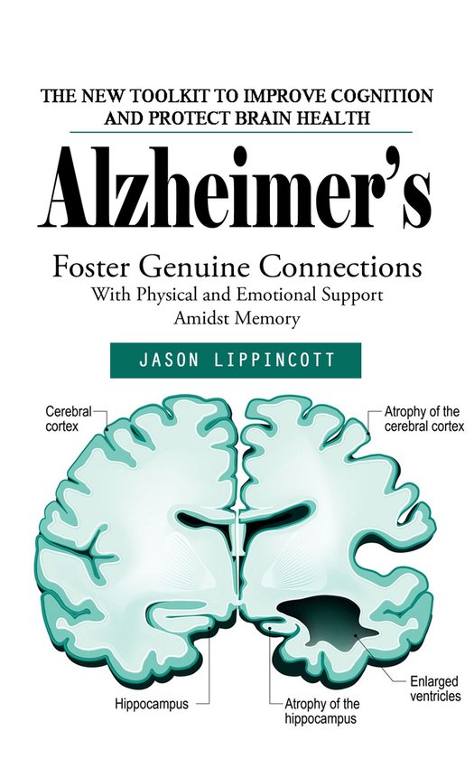 Alzheimer’s: The New Toolkit to Improve Cognition and Prot ... - cover
