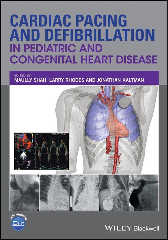 Cardiac Pacing and Defibrillation in Pediatric and Congenita ... - cover