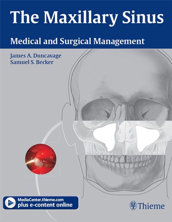 The Maxillary Sinus