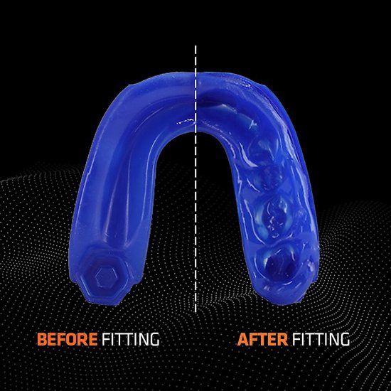 Koning-blauwe Shock Doctor mondbeschermer, "BEFORE FITTING" aan de linkerkant en "AFTER FITTING" aan de rechterkant.