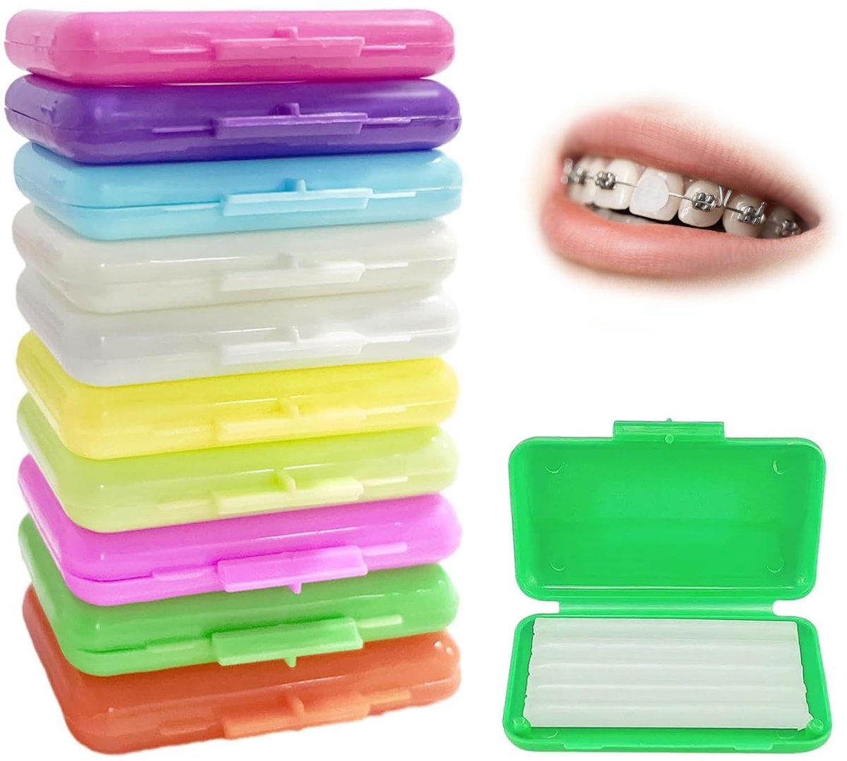 SolidKeus - 10 Dozen Orthodontische Was voor Beugels