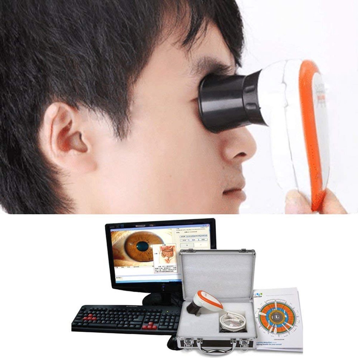 Iriscope 5.0MP High Resolution - 30x IRIS lens - ooggezondheid analyse - verbeter uw welzijn - ShopVlot