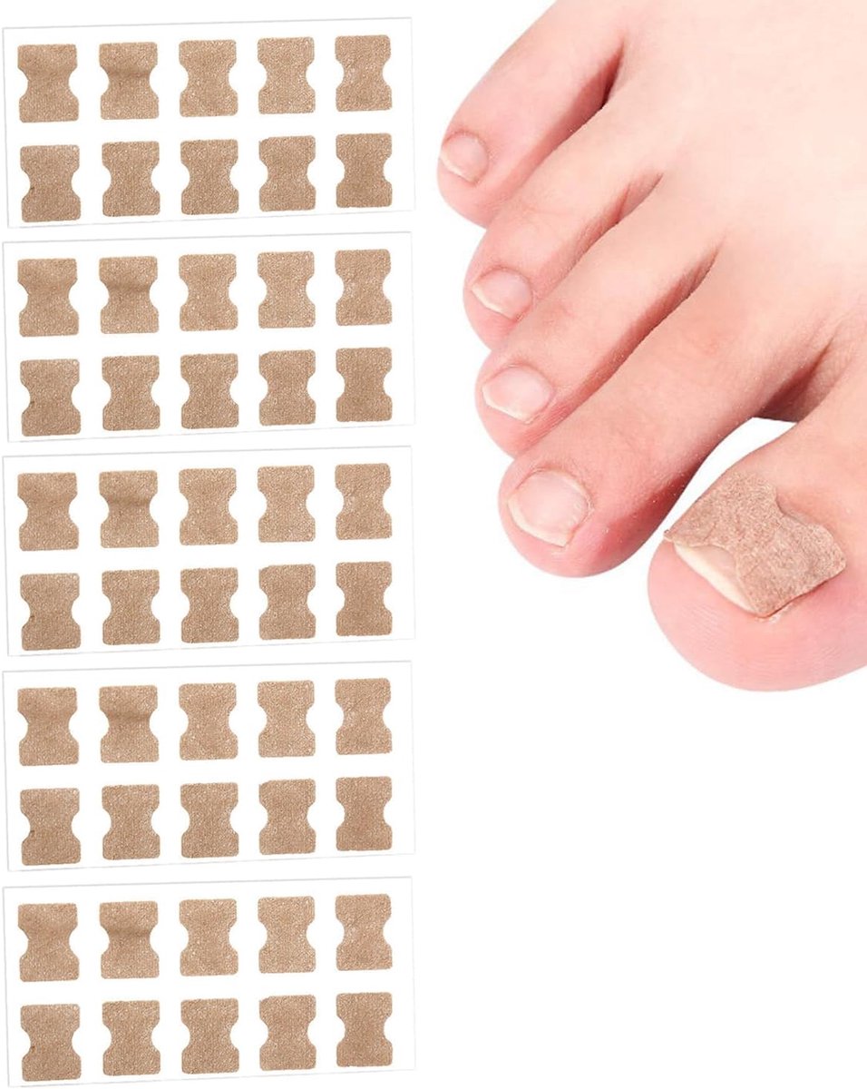 50 stuks ingegroeide nagelpatches, ingegroeide nagelstiftpatch, nagelcorrectiestickers, ingegroeide nagels, correctie van ingegroeide nagels, correctiepatch voor nagels
