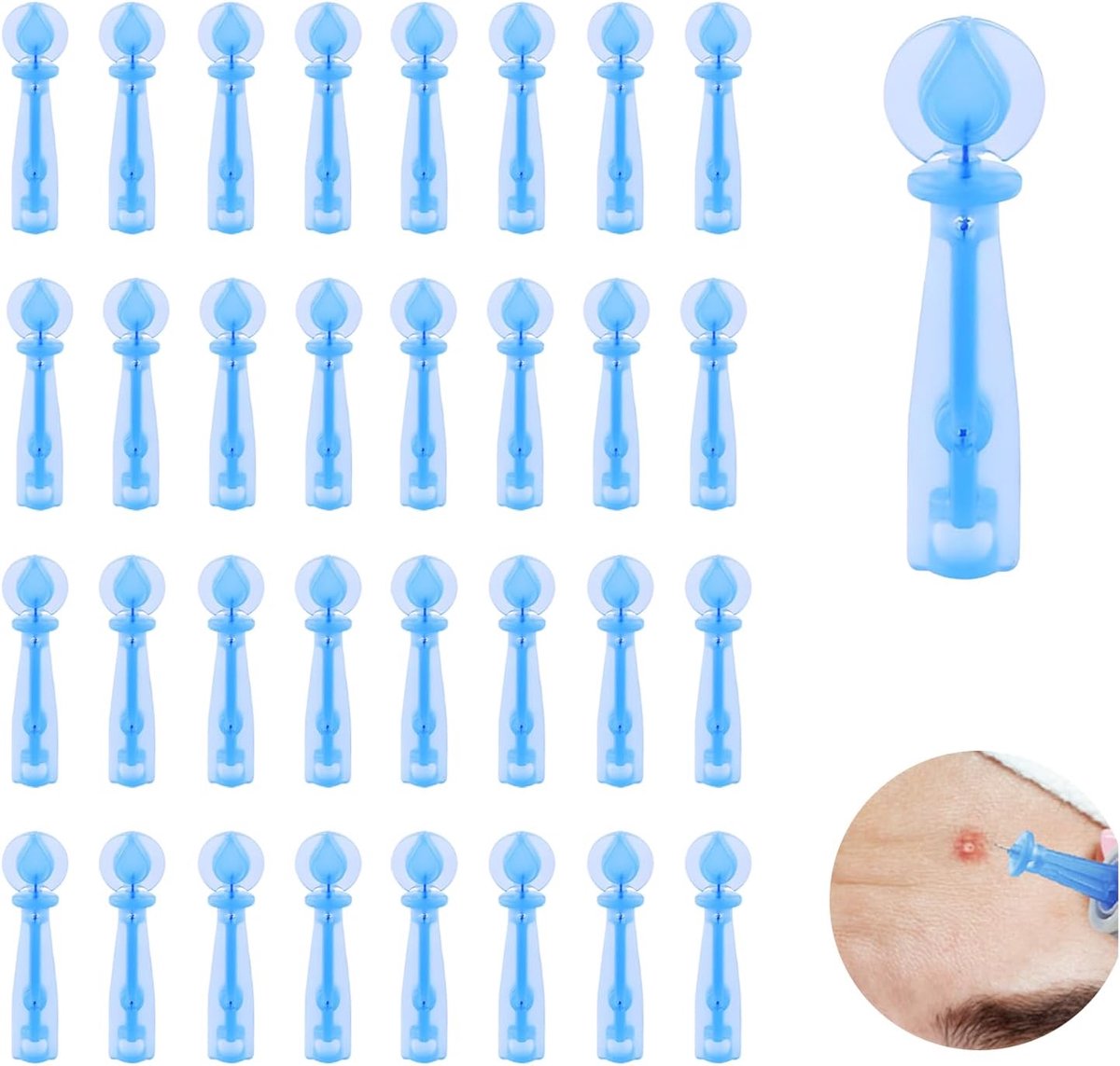 SnelShoppen - 100 Stuks Blackhead en Onzuiverheid Verwijderaar Set, Acne Pimple Popper Naald, Pimple Naalden, Zwarte Punt Verwijder Set van Hoogwaardi