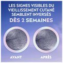 Voor en na foto's van huid met rimpels, tekst: Les signes visibles du vieillissement cutané semblent inversés dès 2 semaines.