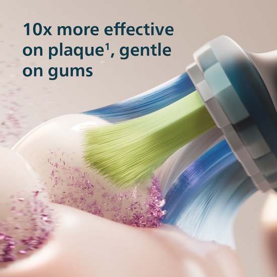 Close-up van Philips Sonicare borstelharen die tandplak verwijderen van de tanden.