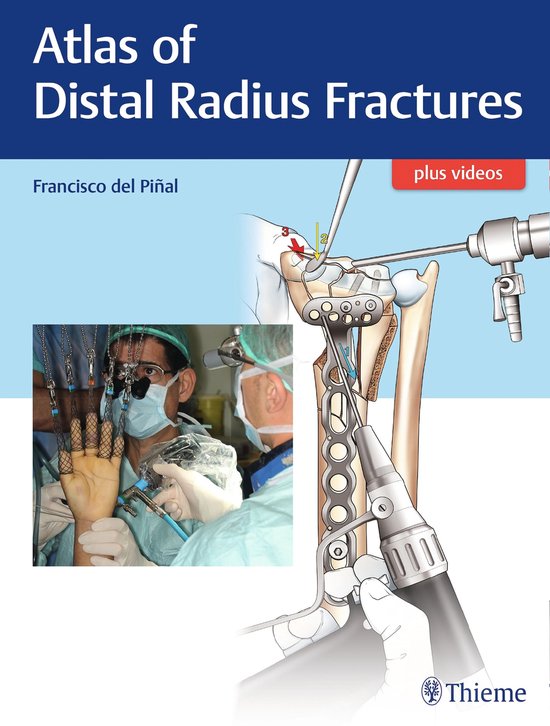Atlas of Distal Radius Fractures - cover