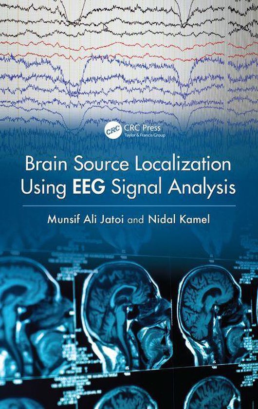 Brain Source Localization Using EEG Signal Analysis - cover