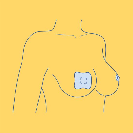 Hydrogel Pads - ideaal voor tepelverzorging - direct verkoelend en verlichtend effect - First Days Maternity van First Days Maternity — afbeelding 4
